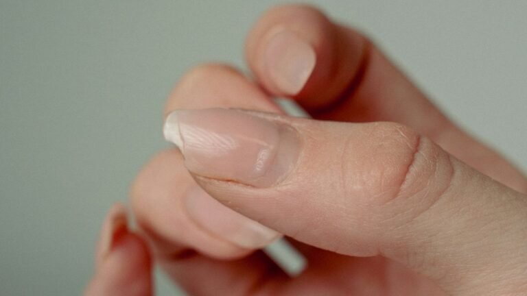 Ongle fendu verticalement