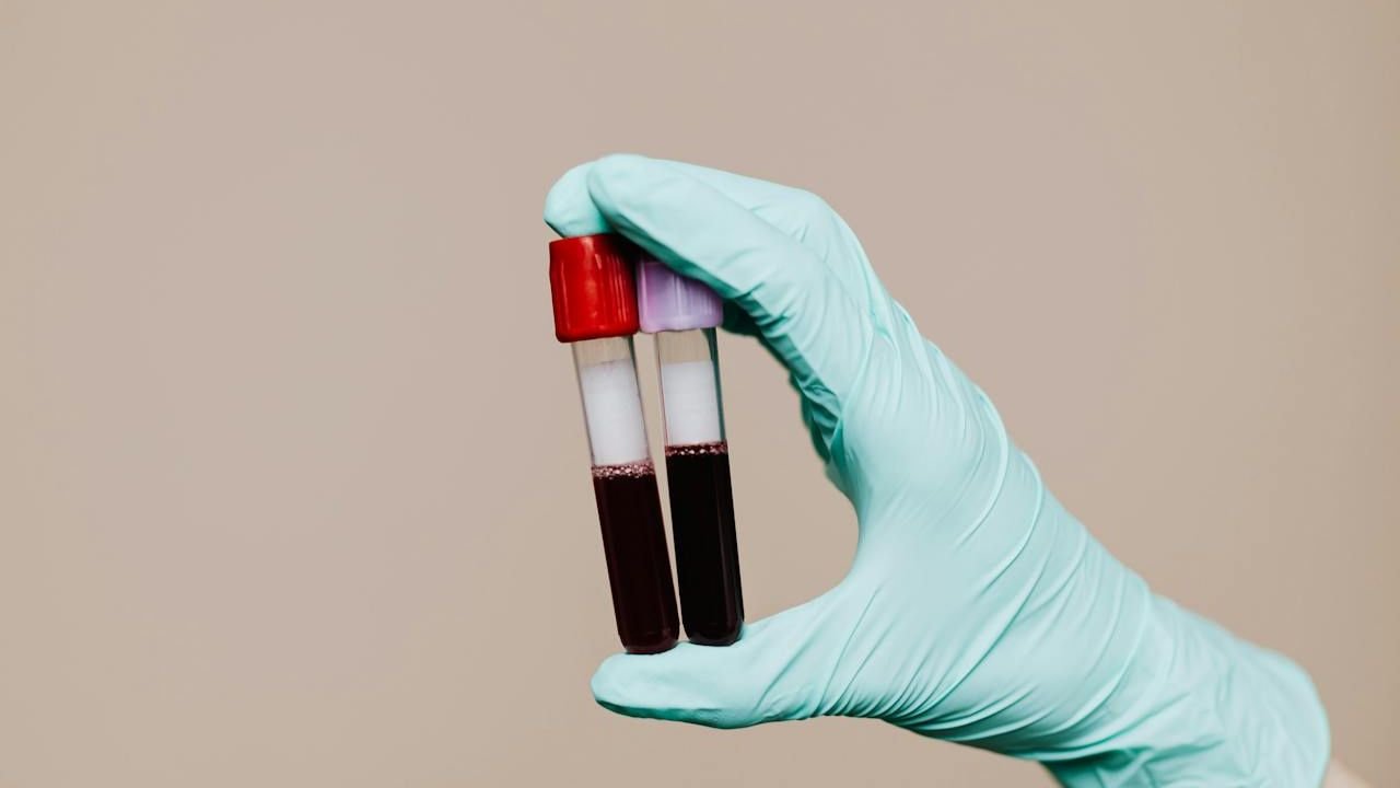 Dosage du cortisol à 8h à jeun