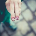 La matrice de l’ongle est atteinte